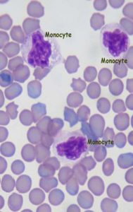 Why Are The Number Of Monocytes In My Dog Or Cat S Blood High