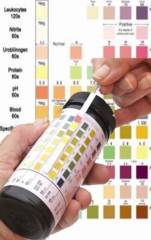 High ascorbic acid outlet in dog urine