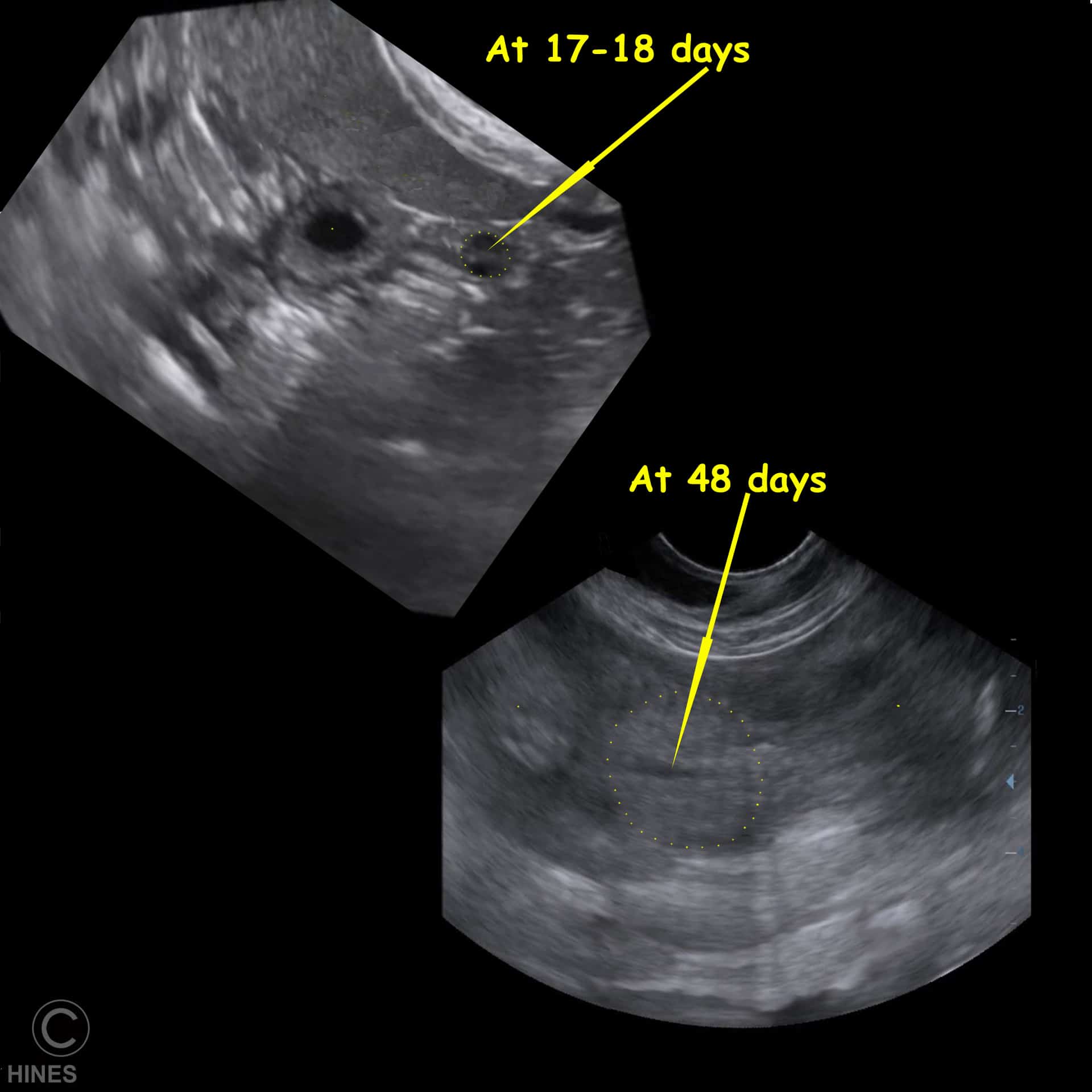 Pregnant dog sonogram